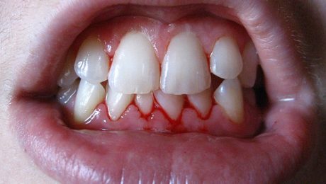 بهترین جراحان دندا در تهران دندانپزشکان برتر جراحی تهران