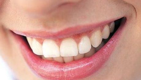 درمان بیماری لثه با بهترین دندانپزشکان تهران نزدیکترین دندانپزشکی به منزل شما