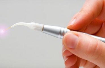 دیود لیزر در سعادت آباد دیود لیز در شمال تهران