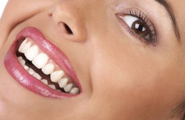 مراقبت از دندانها در ایام عید