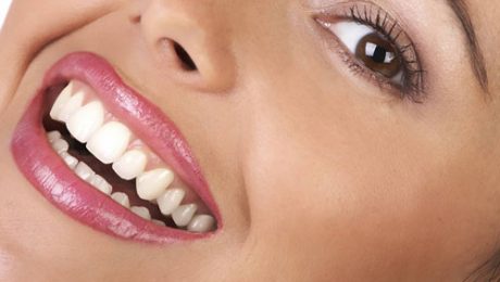 مراقبت از دندانها در ایام عید مراقبت از دندانها در ایام عید