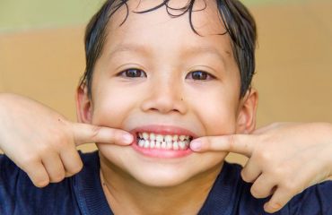 دندانپزشکی کودک دندانپزشکی کودک