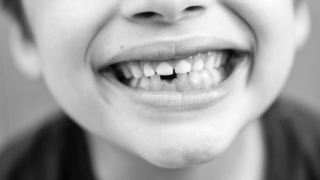 دندانپزشکی کودکان در ونک
