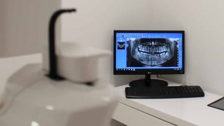 عکس opg چیست؟ عکس opg