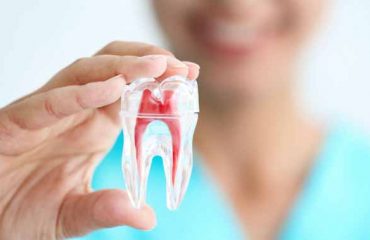 عفونت در دندان عصب کشی شده؟
