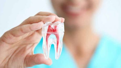 عفونت-در-دندان-عصب-کشی عفونت در دندان عصب کشی شده؟