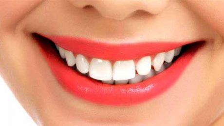 هزینه-دندانپزشکی هزینه دندانپزشکی