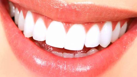 کانتورینگ-لثه-چیست؟ کانتورینگ لثه