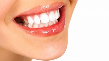 طول-عمر-کامپوزیت-دندان طول عمر کامپوزیت دندان