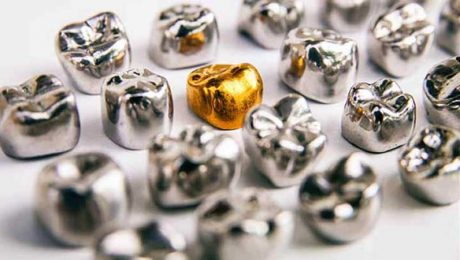 جنس-و-مواد-تشکیل-دهنده-ایمپلنت مواد تشکیل دهنده ایمپلنت