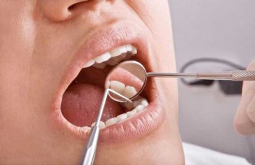 هزینه درمان ریشه دندان هزینه درمان ریشه دندان