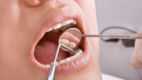 هزینه درمان ریشه دندان هزینه درمان ریشه دندان