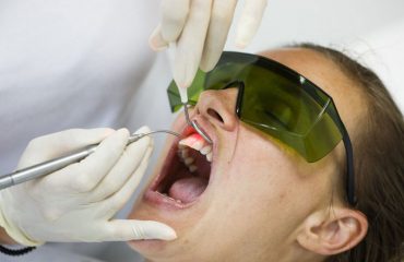 ایمپلنت با لیزر در تهران