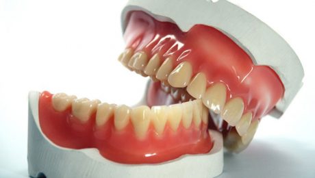 پروتز دندان در تهران