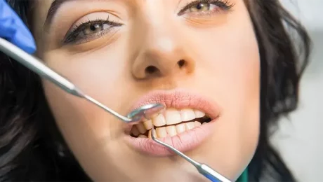 ایمپلنت دندان پوسیده در تهران