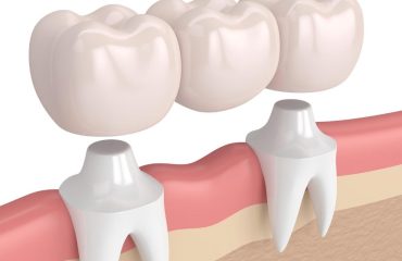 اوردنچر در تهران اوردنچر در تهران